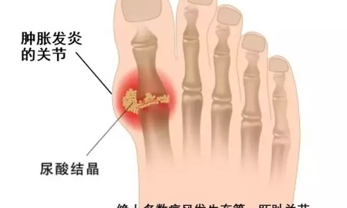 精神病院给病人吃什么药-现在的精神病院的病人都吃什么网 - 为你提供精神病院给病人吃什么药、精神病院伙食吃什么